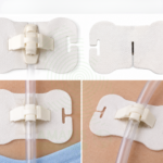 Body surface conduit fixing device - Type B Amaris Medical