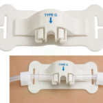 Body surface conduit fixing device - Type G Amaris Medical