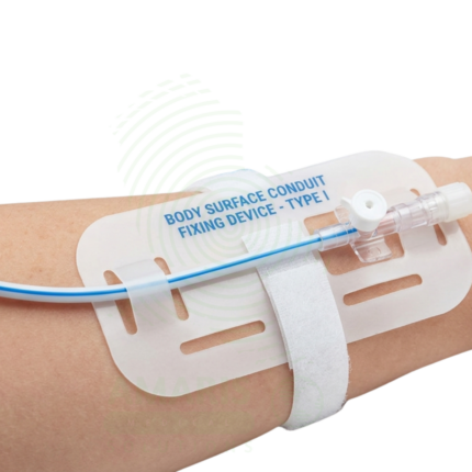 Body surface conduit fixing device - Type I Amaris Medical
